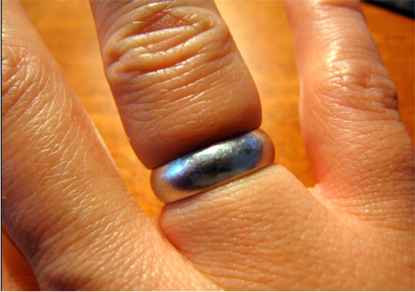 Как снять кольцо с опухшего пальца в домашних условиях
